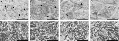 The dynamic changes of mango (Mangifera indica L.) epicuticular wax during fruit development and effect of epicuticular wax on Colletotrichum gloeosporioides invasion